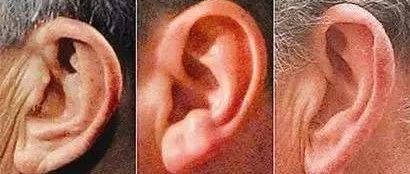 耳朵上出现这些特征，是大病的征兆！